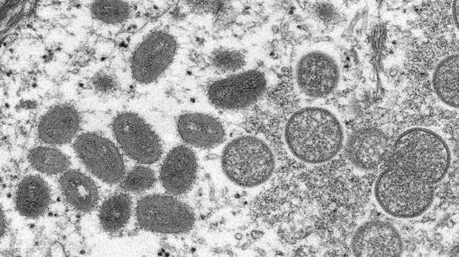 Sobe para 142 o número de casos de varíola dos macacos