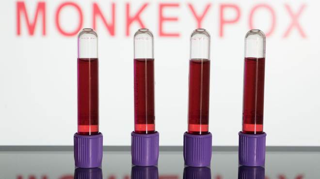 Anvisa autoriza uso emergencial de kits para varíola dos macacos