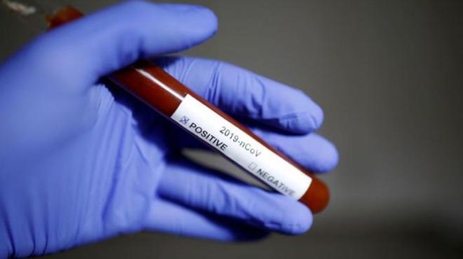 Pandemia para o novo coronavírus – Declaração OMS