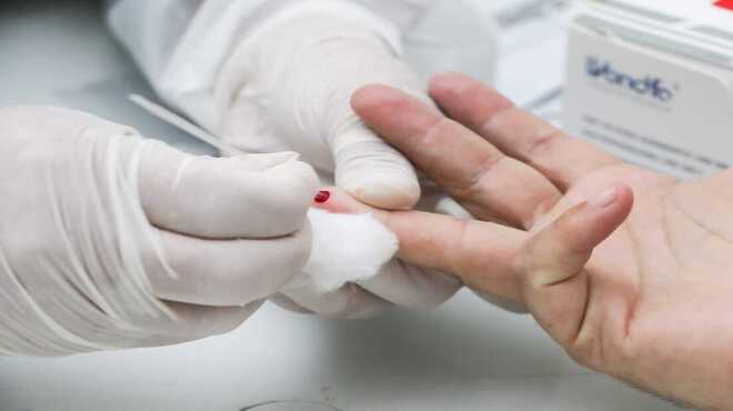 Covid-19: Rio anuncia testagem maciça na população e não fecha comércio