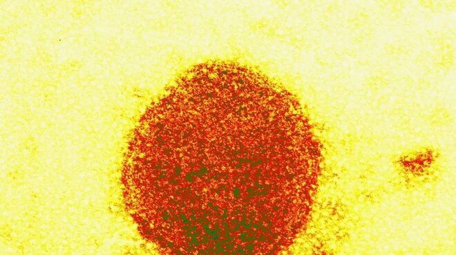 Henipavírus: novo vírus de origem animal infecta 35 pessoas na China, aponta estudo