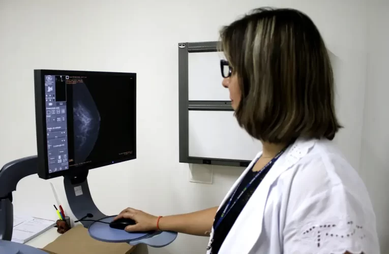 Entidades médicas pedem faixa etária maior para mamografia de rastreio
