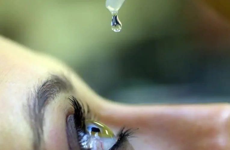 Uso inadequado de corticoides pode aumentar casos de glaucoma, alerta especialista